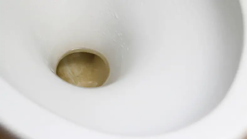 Brown stains at the bottom of a toilet bowl